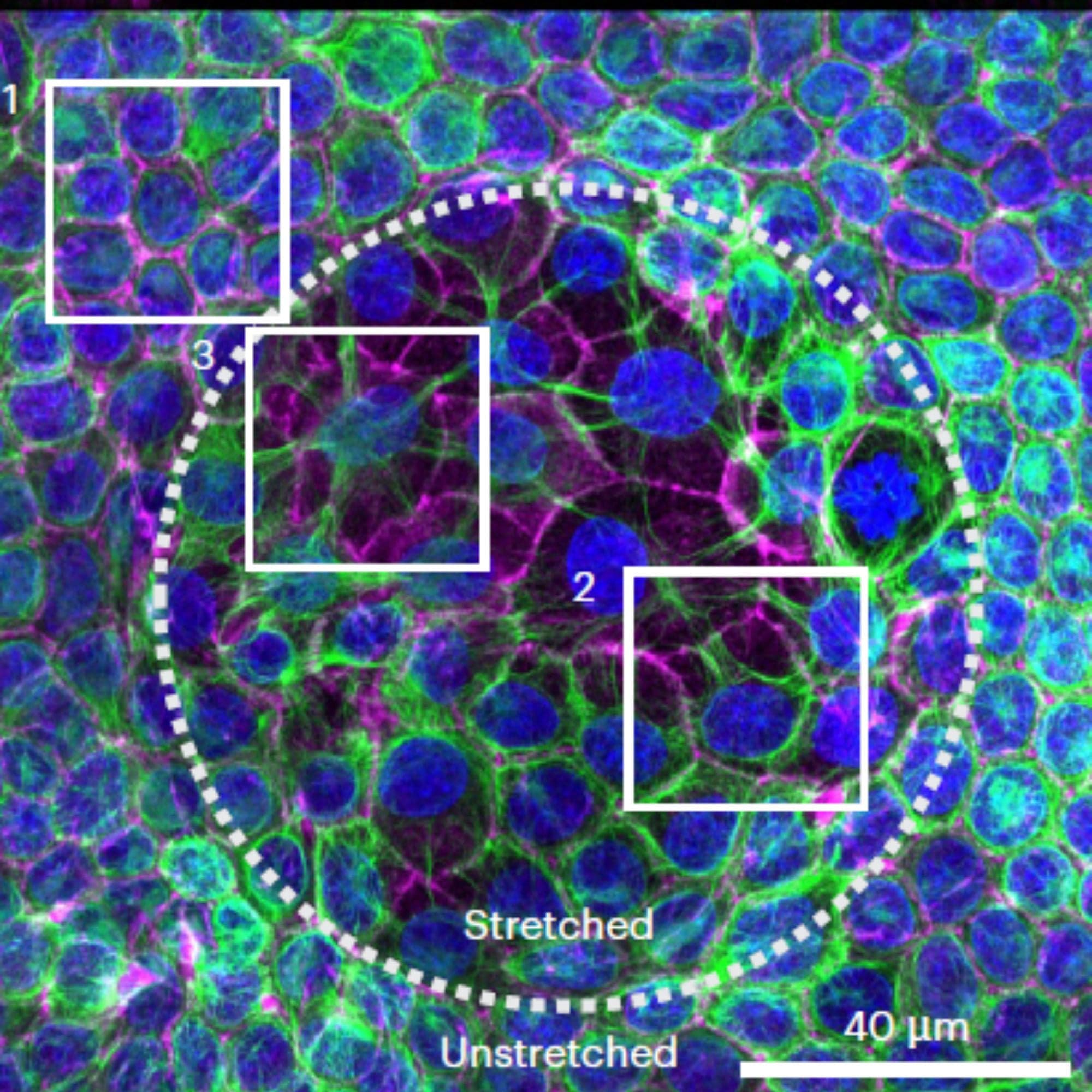 Cells Join Forces To Survive Prolonged Mechanical Strain